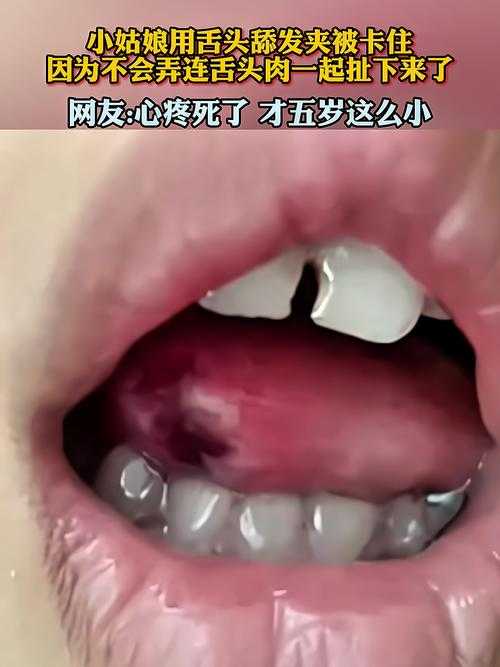 舌头舔到硬物包疼痛难忍令人担忧