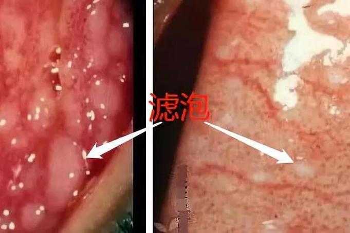 镜流口水白色液体怪异现象引发关注