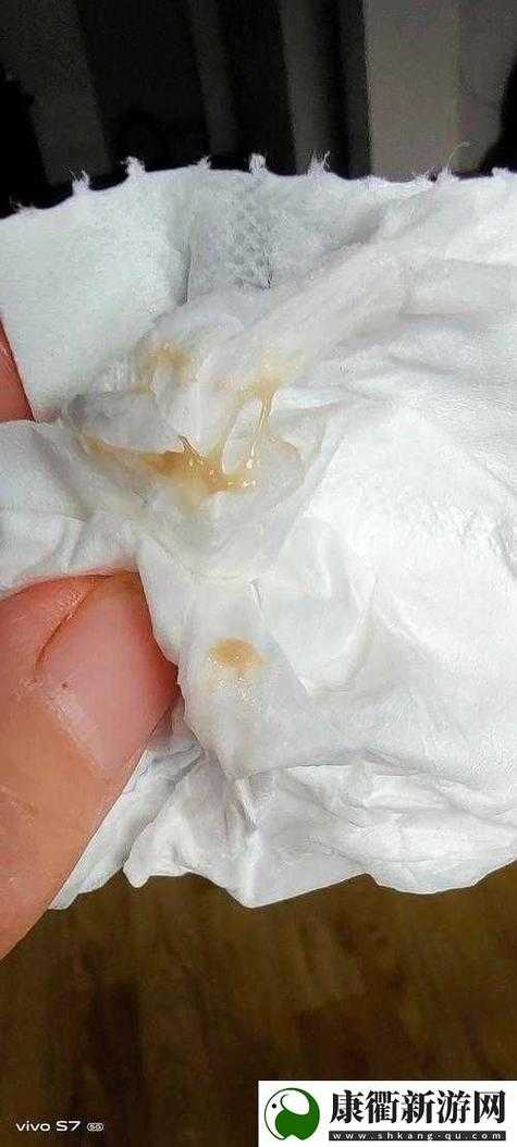 胡桃身体异常流出白色脓状物引关注