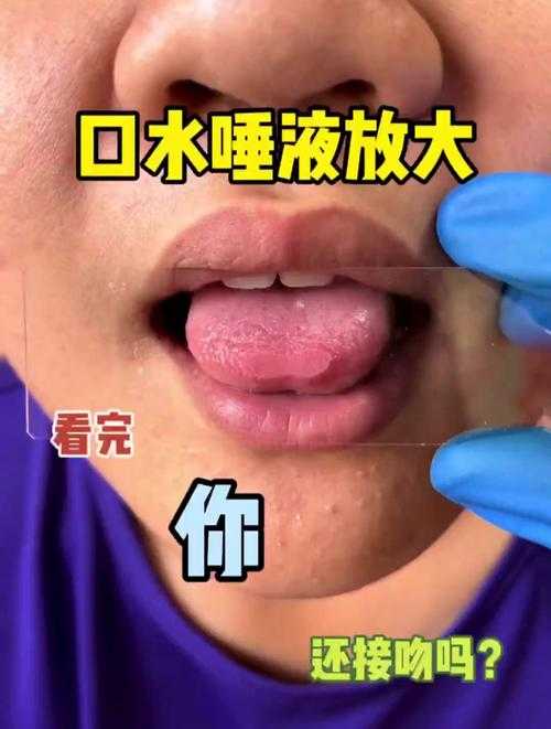 镜流口水流白色液体正常吗探讨其背后的生理现象及潜在原因