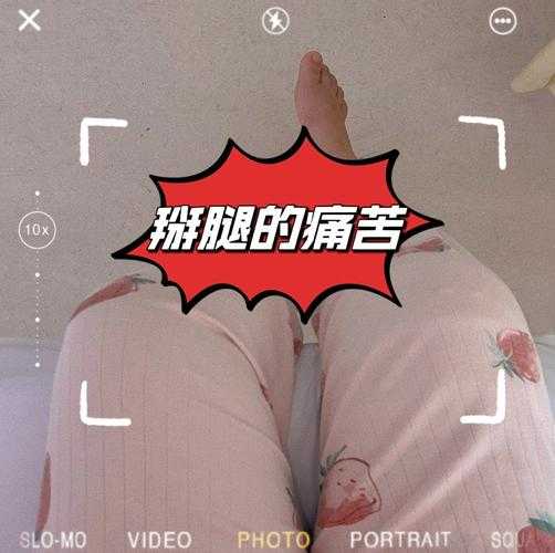 女生在打扑克过程中因迈开腿而致又疼又痒的奇妙经历