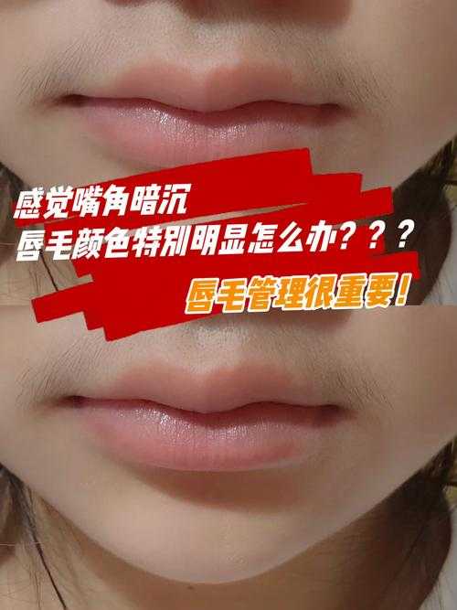 16岁唇毛明显到18岁还会长吗了解其生长规律及应对之法